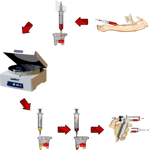 prp1