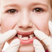 baby_caries_1